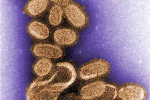 Evolution of 1918 Flu Virus Traced from Century-Old Samples